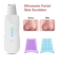 Exfoliante Ultrasonico de la Piel Limpieza Profunda de Poros Faciales