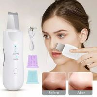 Limpiador Facial Espátula Ultrasónico Limpieza Profunda Portatil