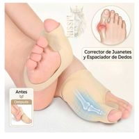 CORRECTOR DE JUANETE PARA LOS DEDOS DEL PIE - UNISEX