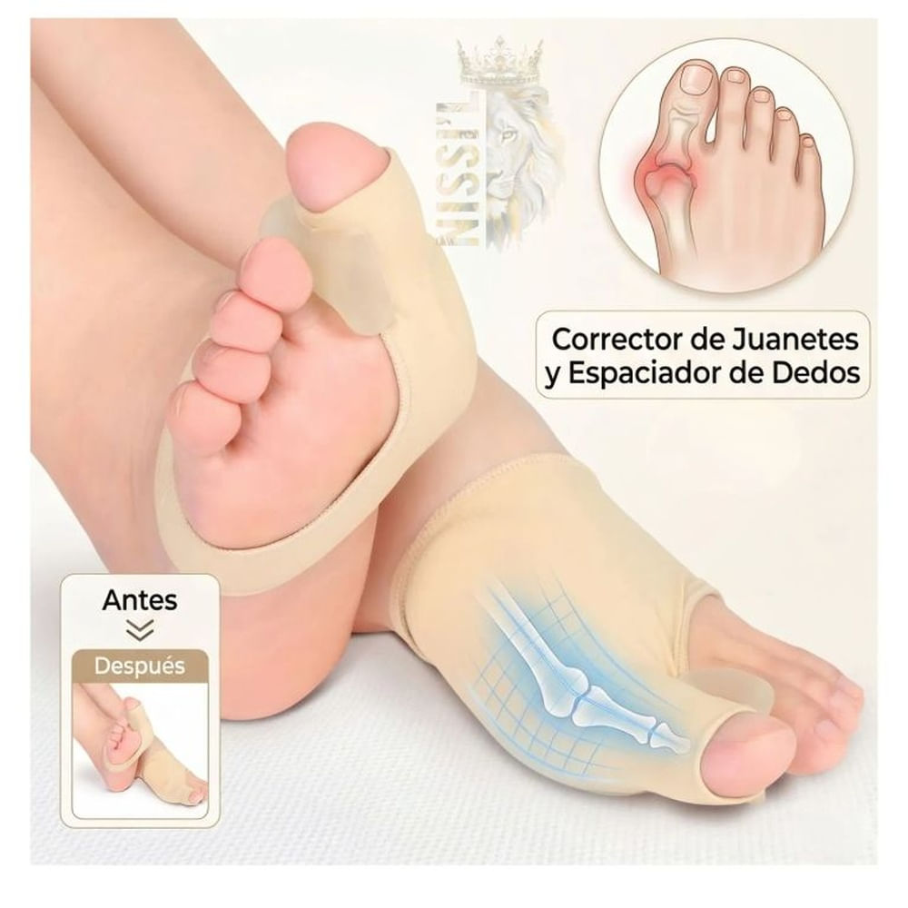 CORRECTOR DE JUANETE PARA LOS DEDOS DEL PIE - UNISEX