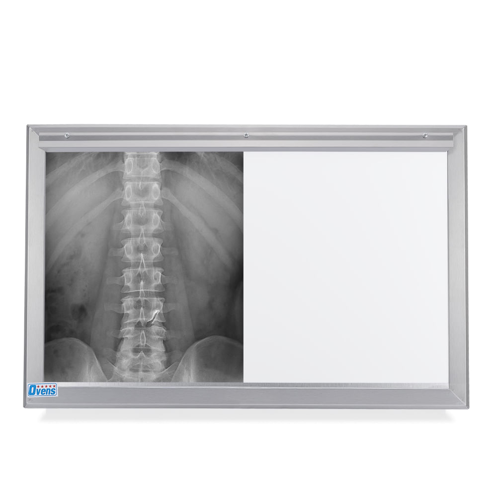 Negatoscopio Fluorescente de 2 Campos en Acero Integro