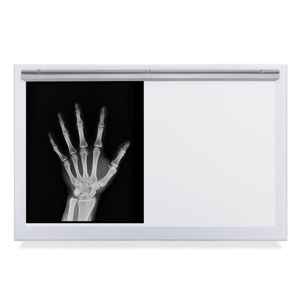 Negatoscopio Fluorescente de 2 Campos en Acero Pintado